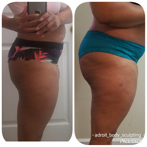 Adroit Body Sculpting