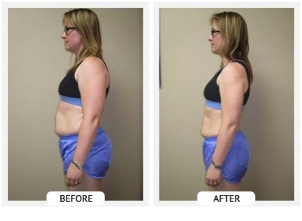 Ballantyne Weight Loss Center