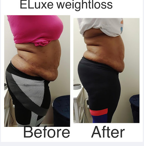 Eluxe Weightloss & Aesthetics