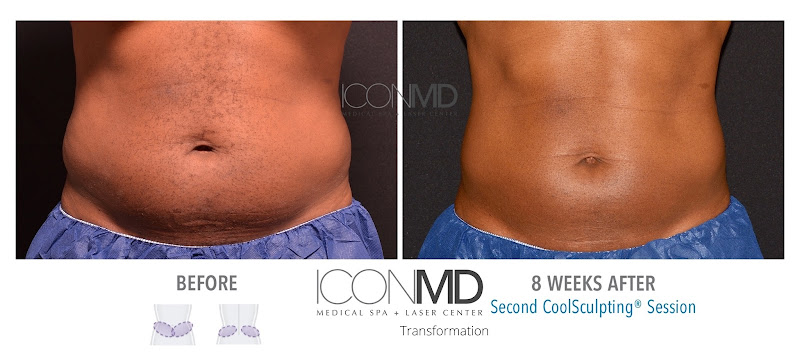 Icon MD Medical Spa + Laser Center Boston