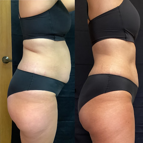 ME Wellness Care & Aesthetics | Emsuite | Weight Loss in Lincoln
