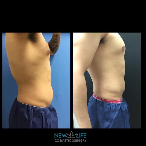 New Life Cosmetic Surgery and Wellness Center