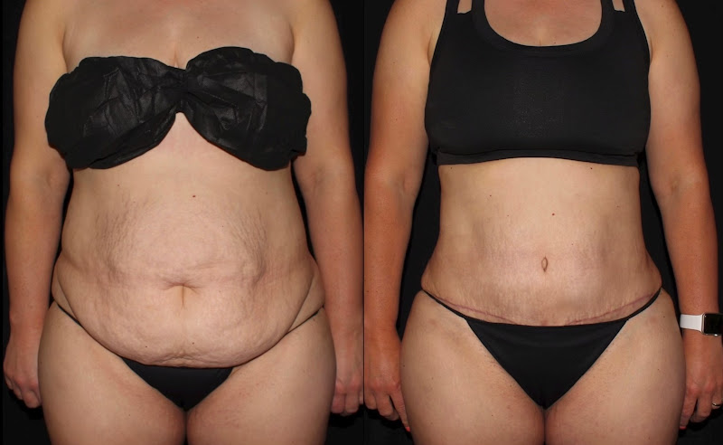 Silk Touch Cosmetic Surgery, Lipo, & Medspa