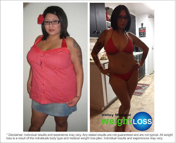 Valley Medical Weight Loss (Tempe)